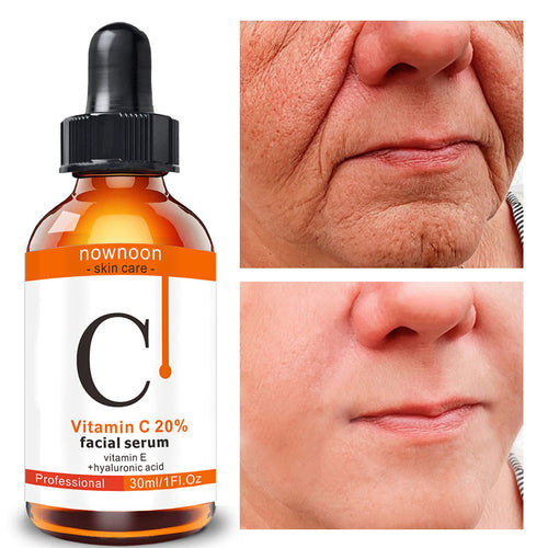 Vitamin C Radiance Boost Facial Serum