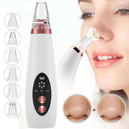 Electric Blackhead Vacuum Pore Cleaner Device